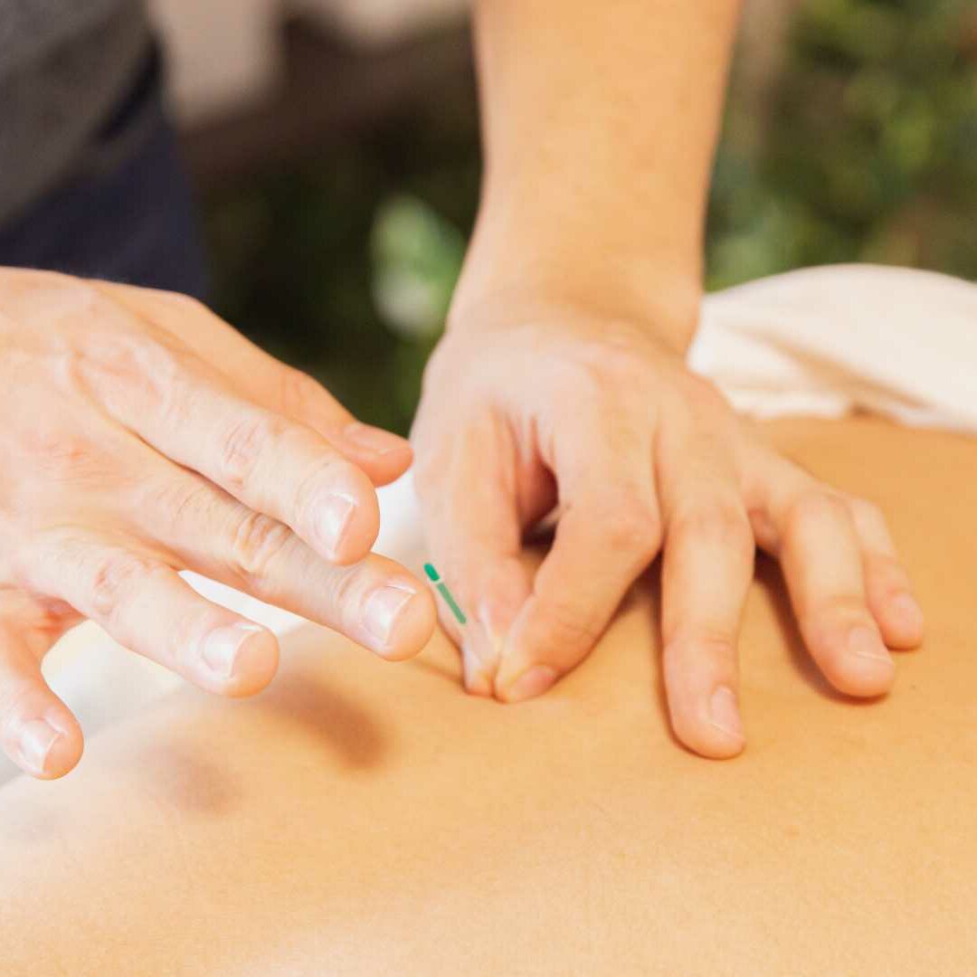 Akupunktur Wolfratshausen